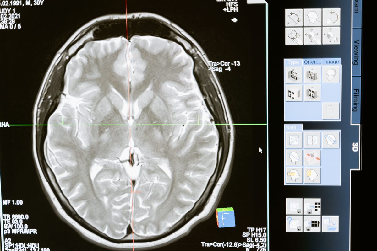 An abstract brain imaging visual in blue tones.
